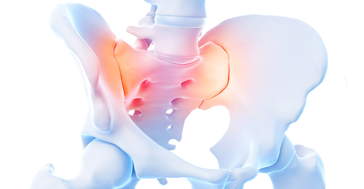 Featured image for Back Pain and the Sacroiliac Joint